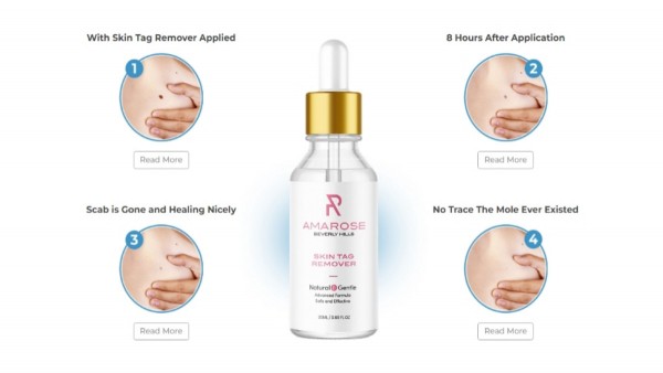3 Paradise Skin Tag Remover Canada Myths, Debunked in 3 Minutes