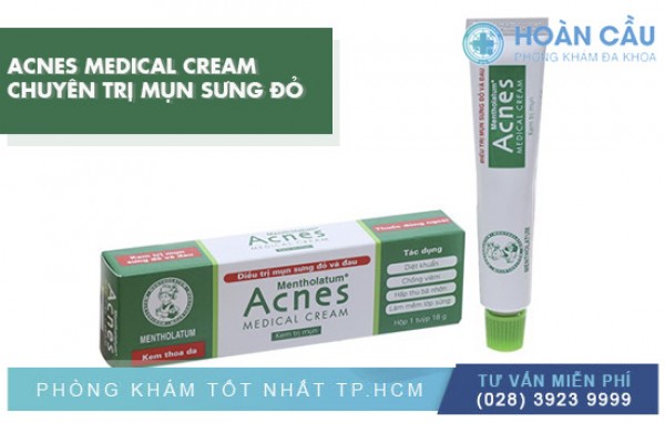 Acnes Medical Cream 18g - Chuyên Điều Trị Mụn Sưng Đỏ