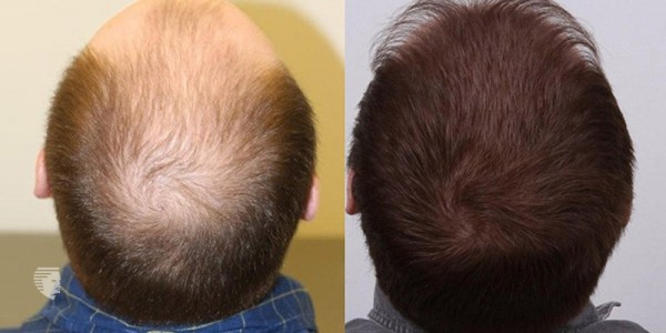 Advanced Hair Growth Reviews