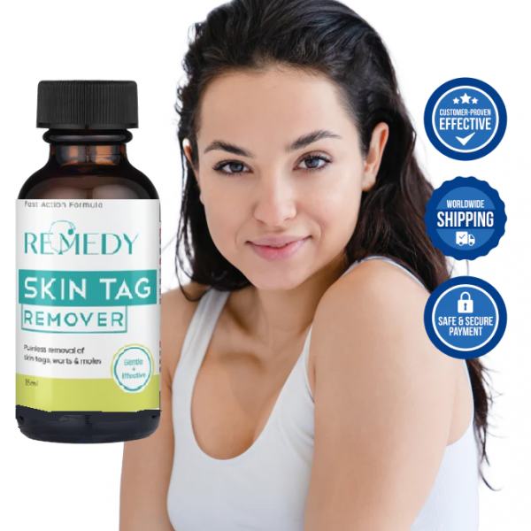 ALERT! Remedy Skin Tag Remover Shocking Reviews or SCAM