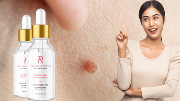 Amarose Skin Tag Remover Review (SCAM Warning!) Know This Now!