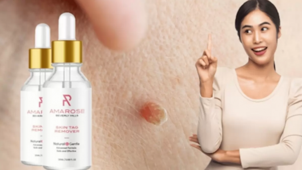 Amarose Skin Tag Remover Reviews - Alarming Customer Complaints! Cheap Scam Product?