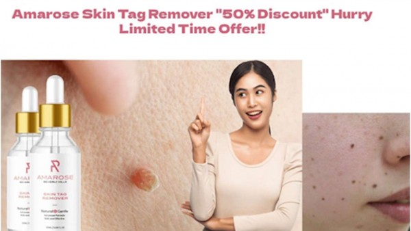 AMAROSE SKIN TAG REMOVER REVIEWS: An Incredibly Easy Method That Works For All!