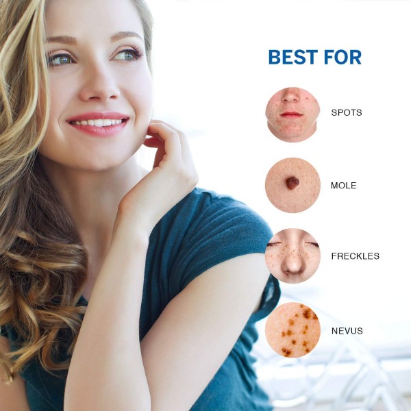 Amarose Skin Tag Remover Reviews: Safe Results or Disturbing Health Claims?