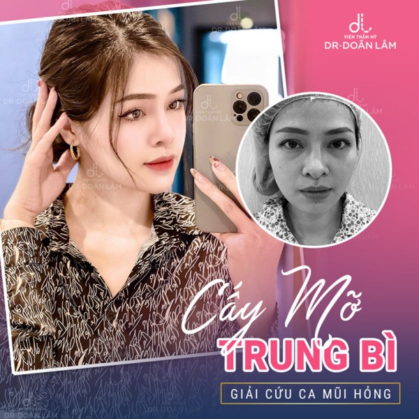 Bác sĩ Doãn Lâm giải cứu mũi hỏng