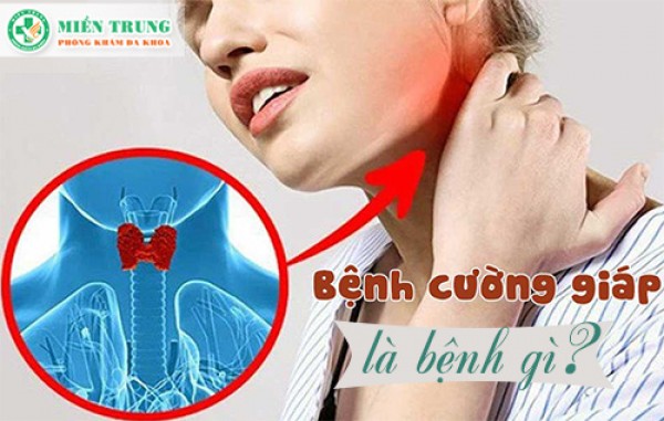 Bệnh cường giáp là gì? Biểu hiện và cách điều trị 