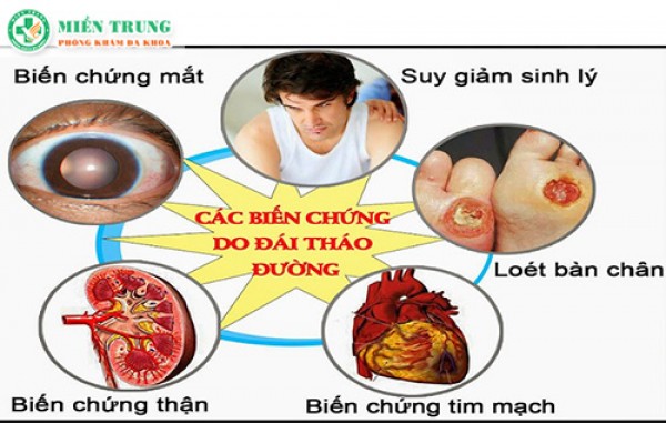 Biến chứng của bệnh đái tháo đường 