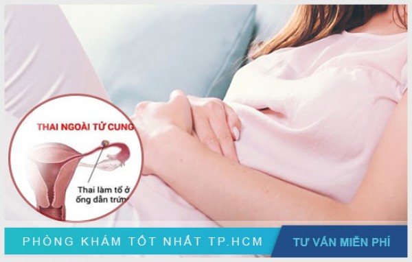 Biến chứng sau mổ thai ngoài tử cung 