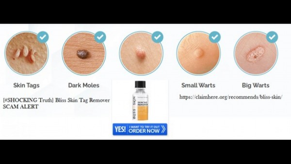 Bliss Skin Tag Remover | Do Not Buy At All Without Knowing This!