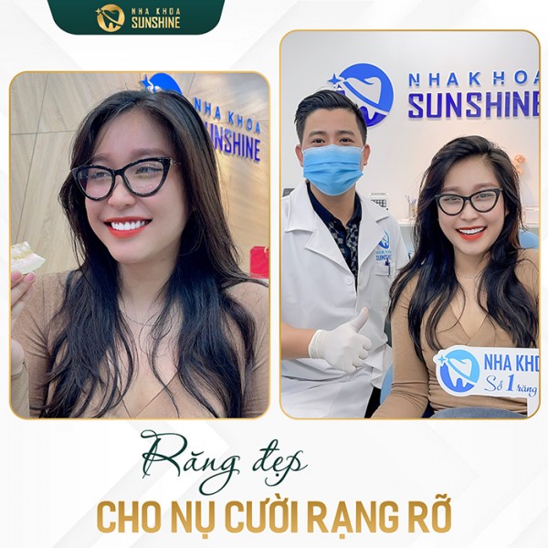 Bọc răng sứ kim loại có tốt không chị em ơi?