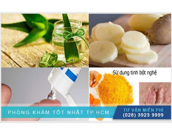 Cách chữa bệnh sùi mào gà ở vùng kín nữ giới tại nhà hiệu quả