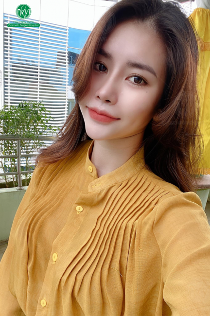 Cách giảm ngực chảy xệ | tamsudaokeo