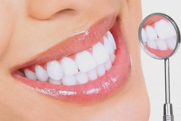 Cách giữ răng trắng sau khi tẩy