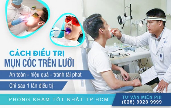 Cách trị mụn cóc trên lưỡi hiệu quả, an toàn 