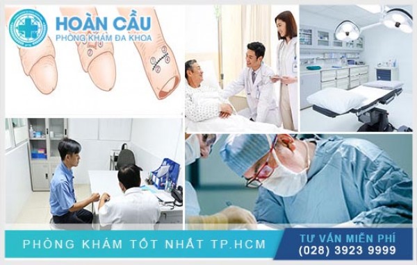 Cắt bao quy đầu ở đâu đảm bảo uy tín và chất lượng?