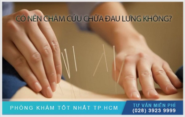 Châm cứu chữa đau lưng - Nên hay không? 