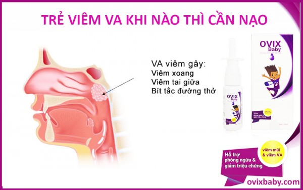 Chia sẻ kinh nghiệm từ mẹ có con viêm VA cho bé không cần nạo