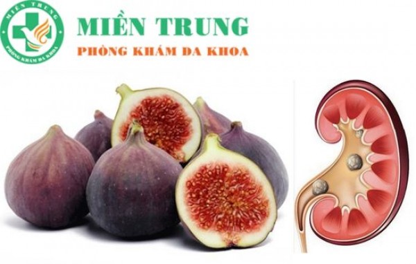 Chữa bệnh sỏi thận bằng cây sung 
