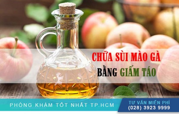 Chữa sùi mào gà bằng giấm táo