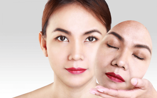 Có nên căng da mặt bằng chỉ collagen hay không?