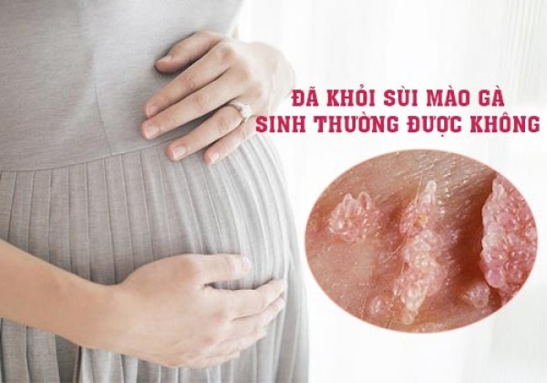 Đã khỏi sùi mào gà có nên sinh thường không?