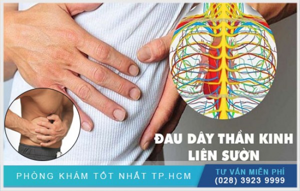 Đau dây thần kinh liên sườn 