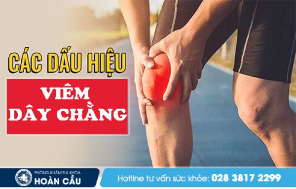 Dấu hiệu nhận biết viêm dây chằng - Đa khoa Hoàn Cầu 