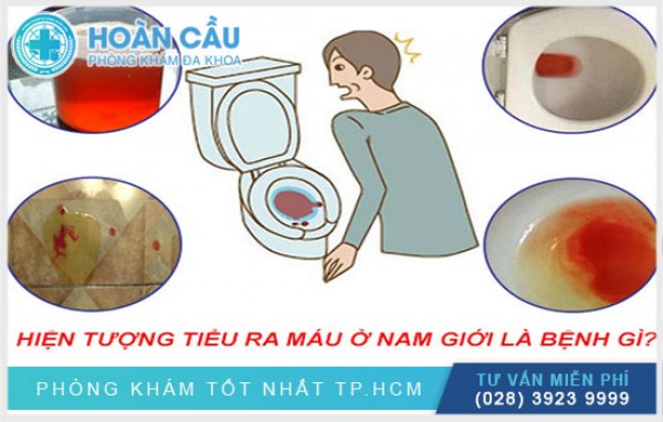 Đi tiểu ra máu là bệnh gì? Cần làm gì khi đi tiểu ra máu?