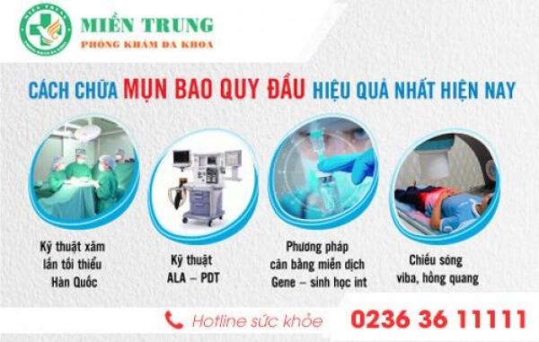 Điều trị mụn trắng rãnh bao quy đầu