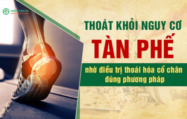 Điều trị thoái hóa khớp cổ chân 