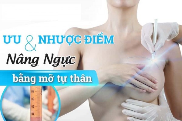 Định giá nâng ngực giá bao nhiêu để thẩm mỹ an toàn
