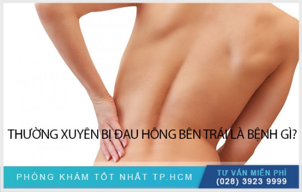 Do đâu mà đau hông bên trái? 