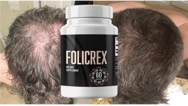 Folicrex Hair Regrowth: Enhancing Hair Health Inside Out