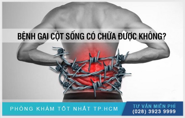 Gai cột sống có chữa được không