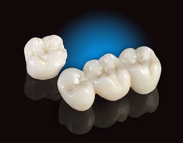 Giải đáp răng sứ ceramill là gì?