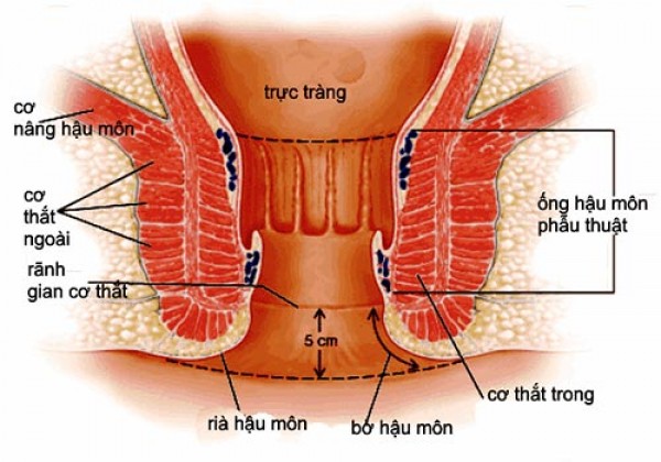 HÌNH ẢNH HẬU MÔN BÌNH THƯỜNG KHÔNG MẮC BỆNH