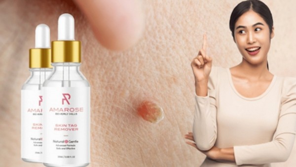 How do Amarose Skin Tag Remover work? Where do I buy the original products official site?