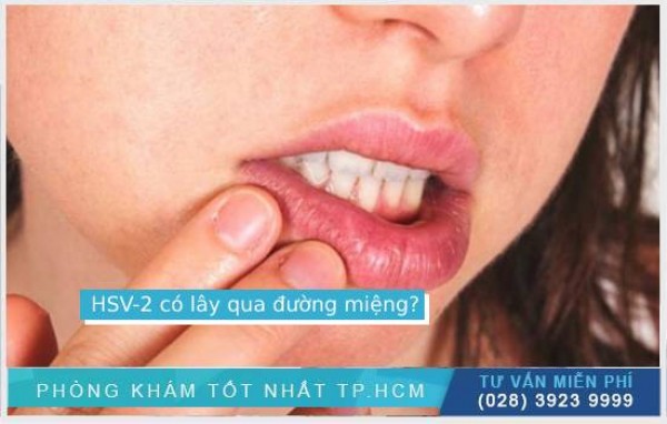 Hsv-2 có lây qua đường miệng không