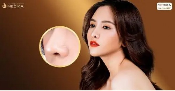 Luận giá nâng mũi sụn sườn bao nhiêu tiền thẩm mỹ hợp lý