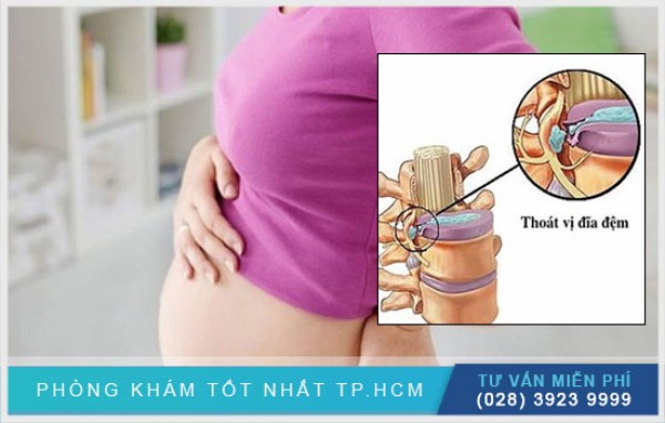 Mẹ bị thoát vị đĩa đệm có mang thai được không? 