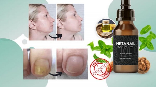 Metanail Serum Pro [Feet Nail Fungus Essention Formula] Includes Powerful Ingredients!