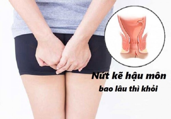 Mổ nứt hậu môn bao lâu thì lành hoàn toàn?