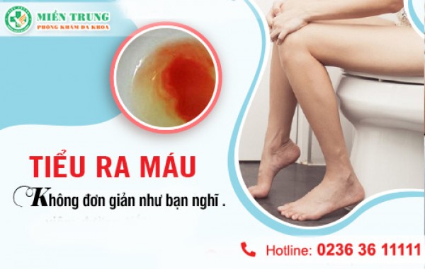 Một số bệnh lý dẫn đến tiểu ra máu 