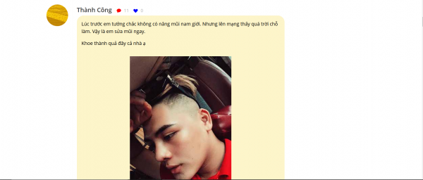 Nâng mũi nam giới đẹp tại BVTMNMH