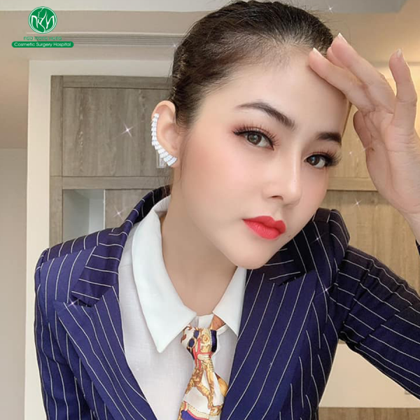 Nâng mũi phá tướng