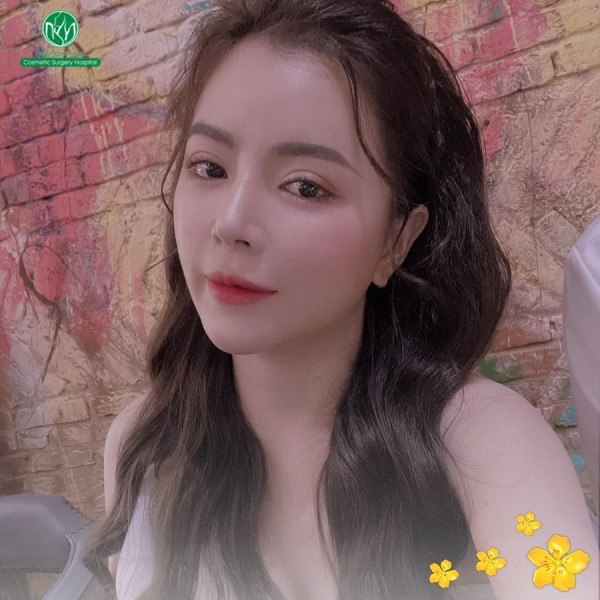 Nâng ngực nội soi 3D túi giọt nước uy tín