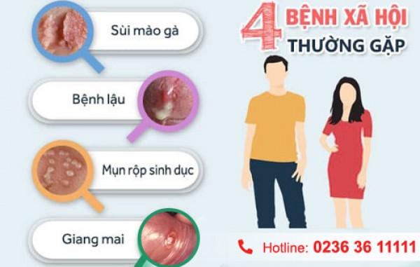 Nguyên nhân mắc bệnh tình dục 