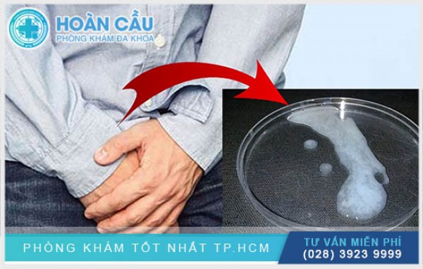 Nguyên nhân và cách điều trị tình trạng tinh trùng vón cục