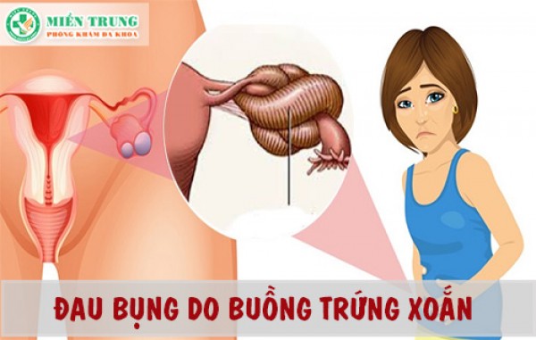 Nguyên nhân và phương pháp điều trị xoắn buồng trứng 