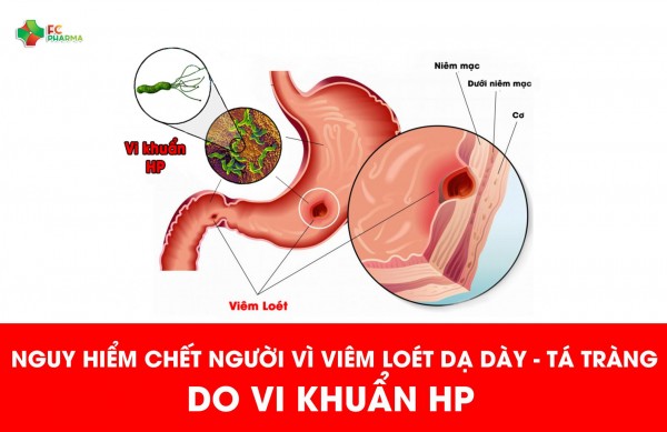 Những lưu ý khi sử dụng thuốc viêm dạ dày đông y